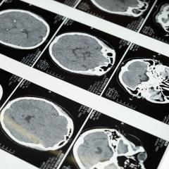 Medical imaging
